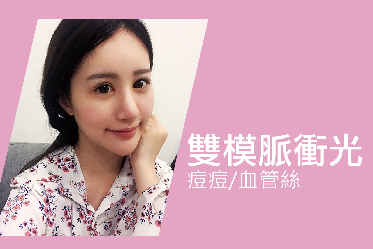 雙膜脈衝光實際案例分享