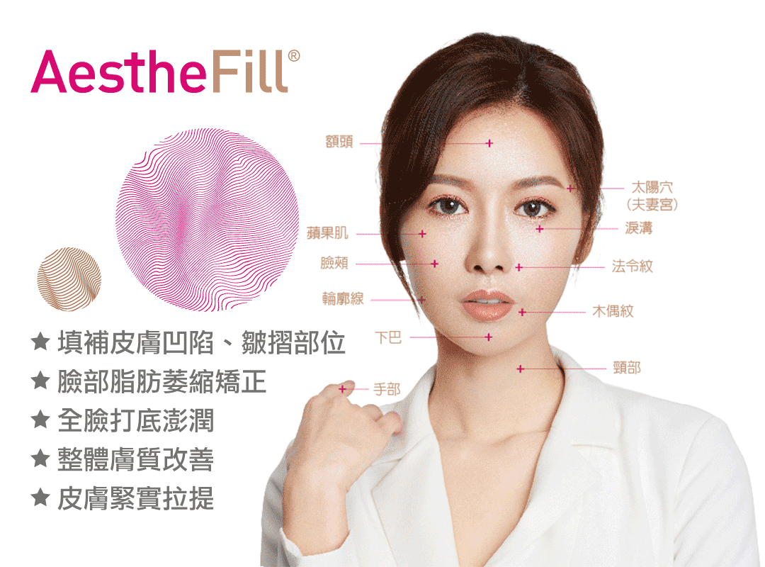 艾麗斯AestheFill®精靈針新型PDLLA聚雙旋乳酸適用部位