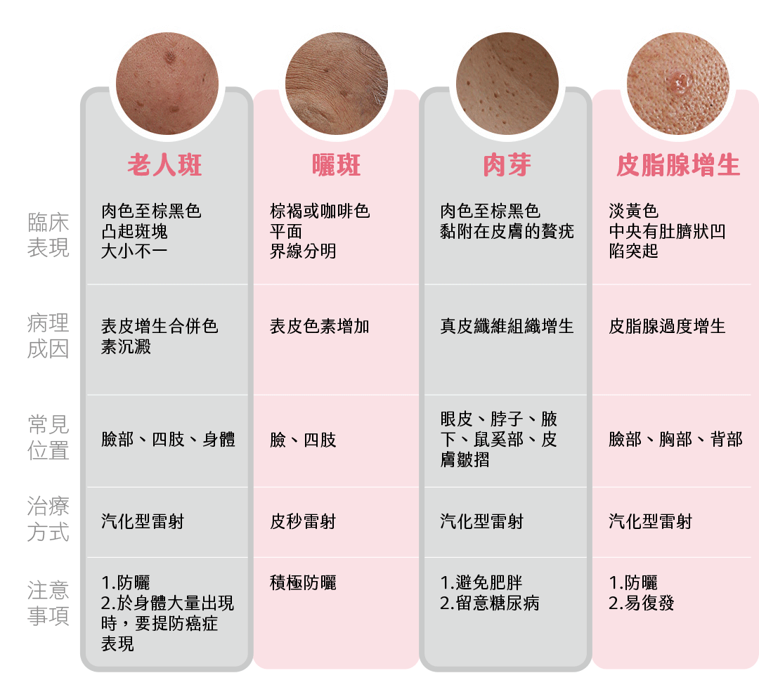 老人斑點判別表格(老人斑/曬斑/肉芽/皮脂腺增生)