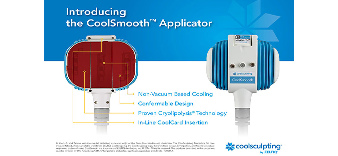 Coolsculpting 酷塑冷凍減脂適用對象
