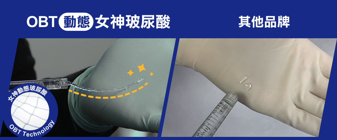動態女神玻尿酸特色
