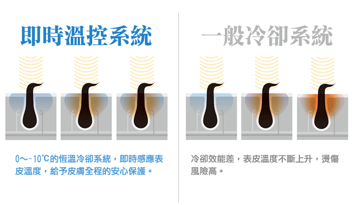 脈衝光IPL療程特色