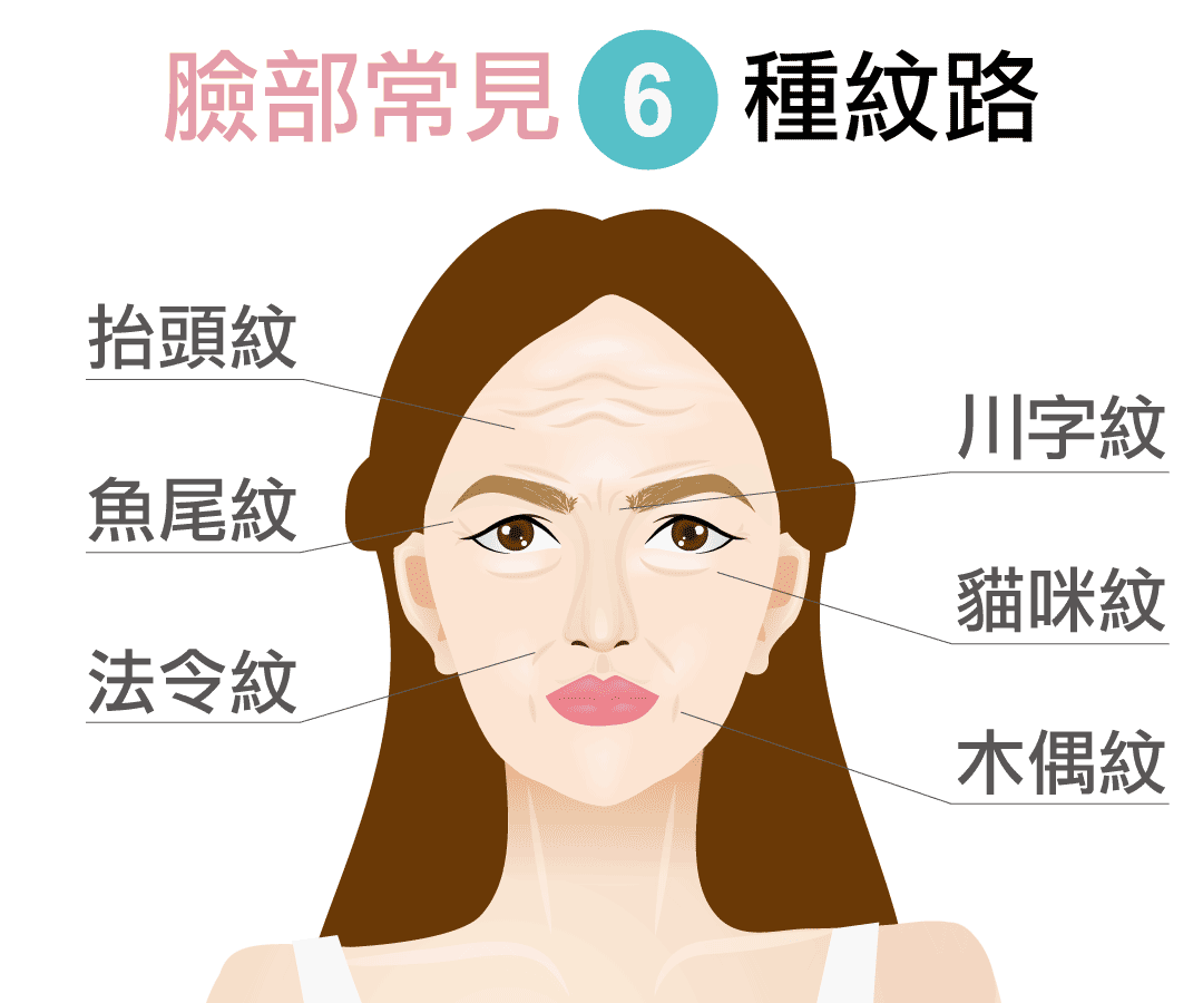 臉部常見的6種紋路