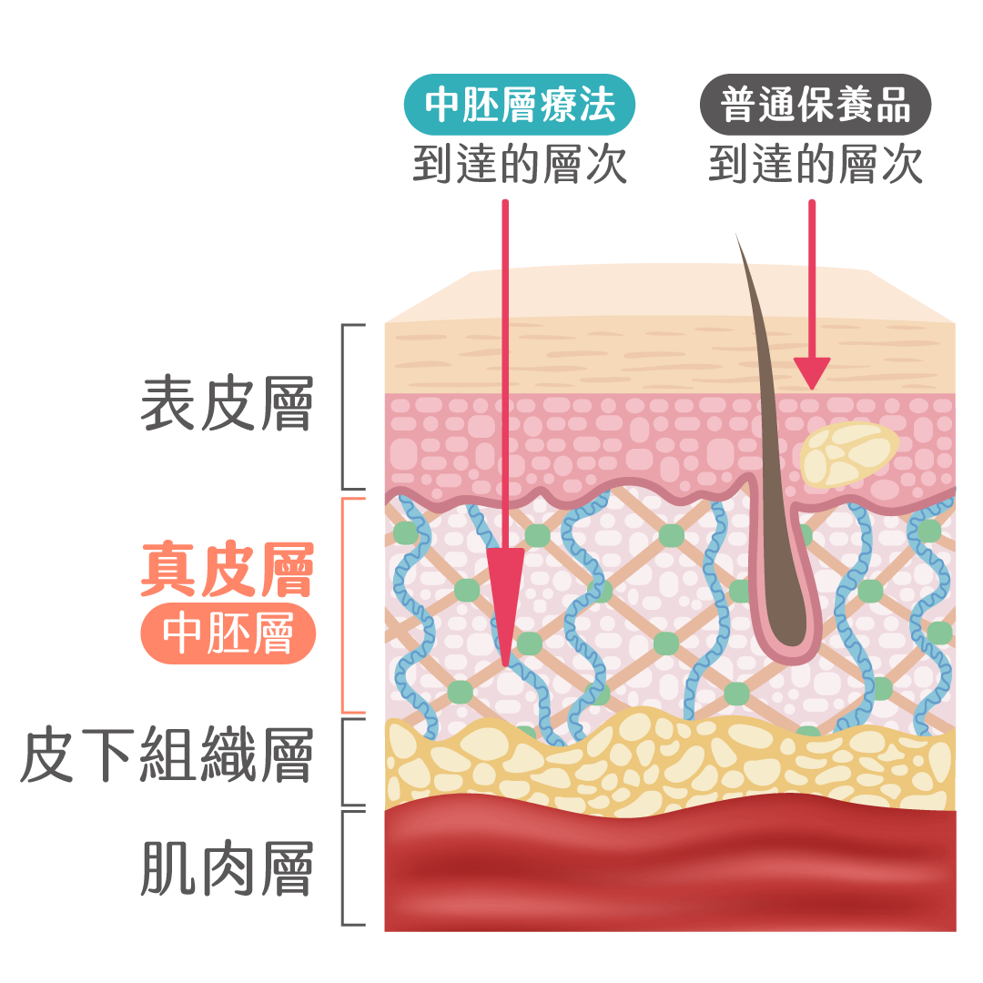 中胚層療法與保養品到達層次的不同說明