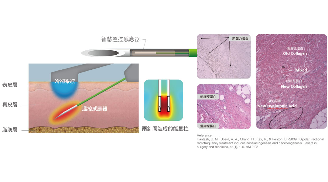Profound魔方電波智慧溫感針