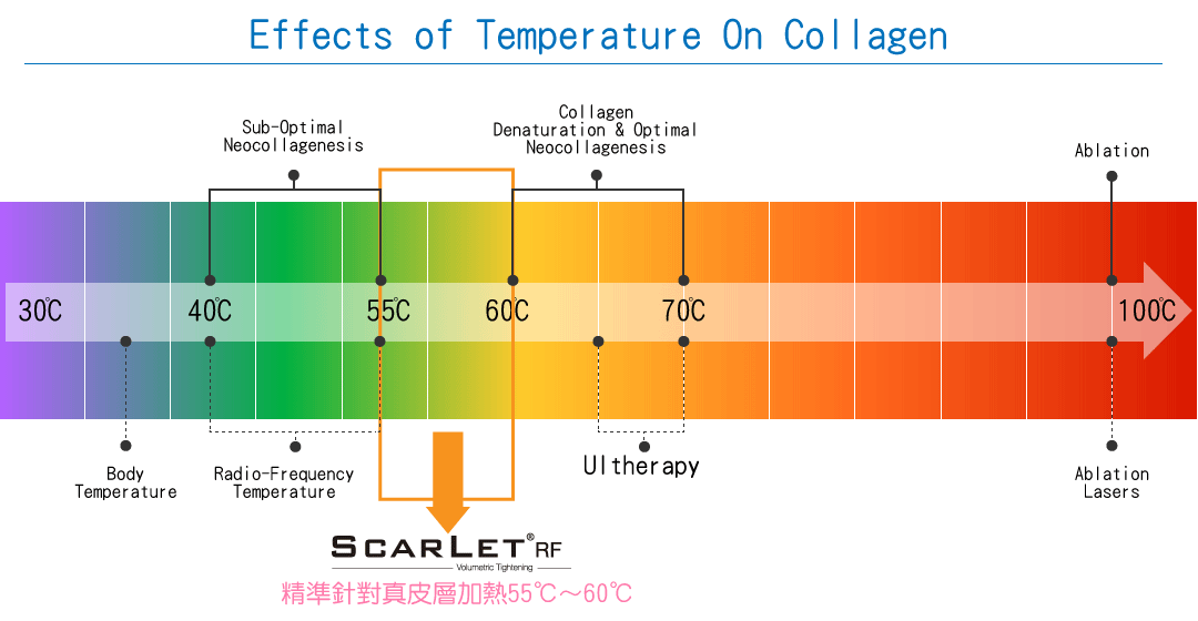 威傲電波拉皮治療溫度表原理說明