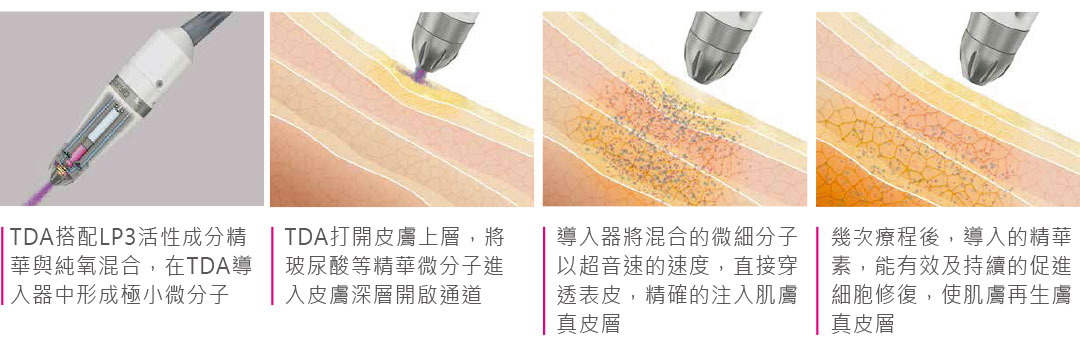 無針水光作用原理