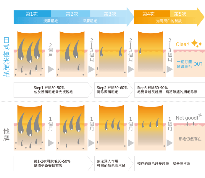 日式極光除毛治療過程-台中除毛推薦