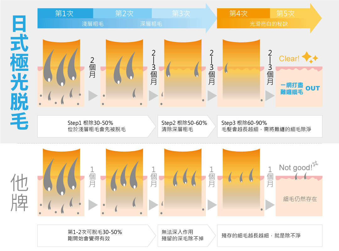 日式極光除毛治療過程-台中除毛推薦