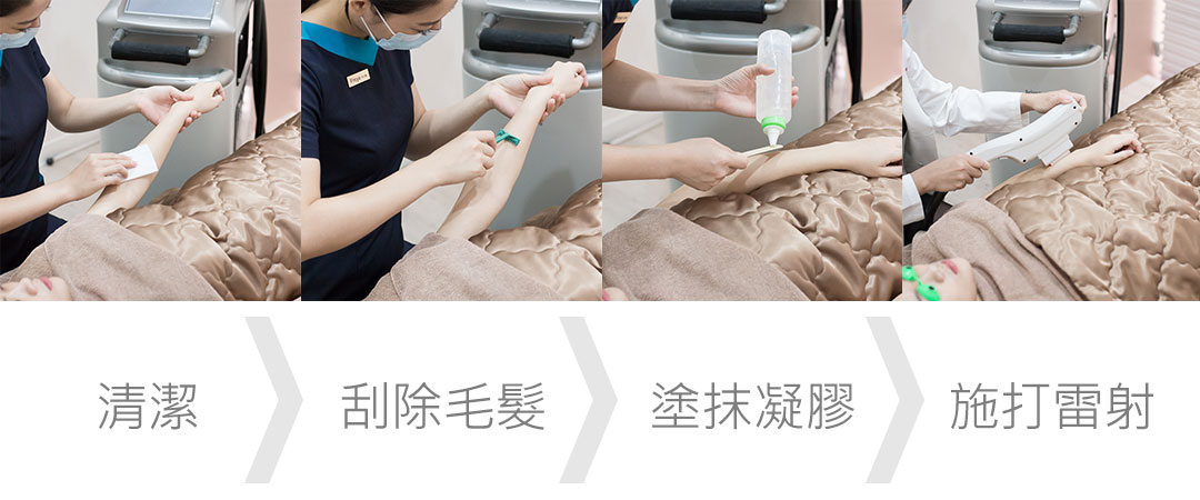 日式極光除毛治療過程-台中除毛推薦