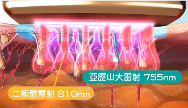 TRITON海神除毛雷射儀器 TRITON海神除毛雷射儀器