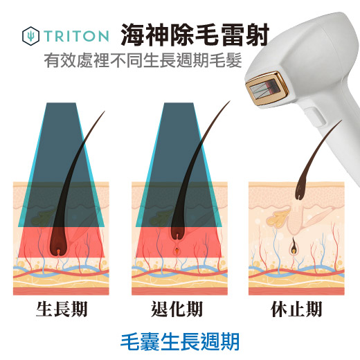 TRITON海神除毛雷射作用技術