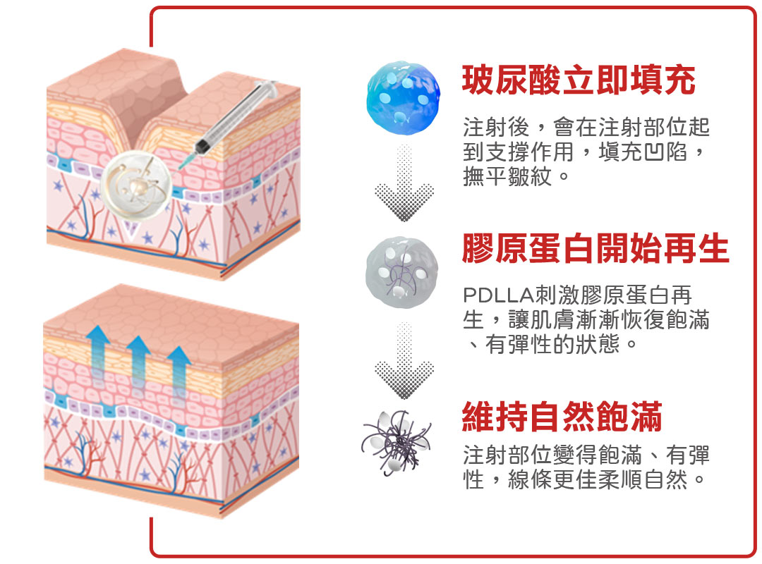 薇貝拉VIVABELLA特色