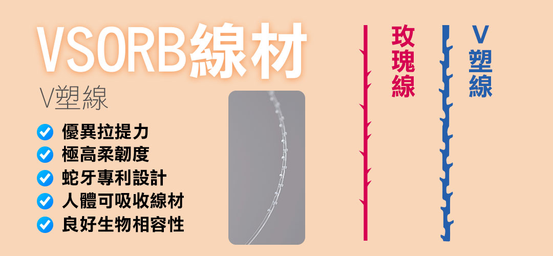 V塑線埋線拉提線材介紹 V塑線埋線拉提線材介紹