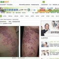 氣溫忽高忽低「皮蛇」帶狀皰疹倍增